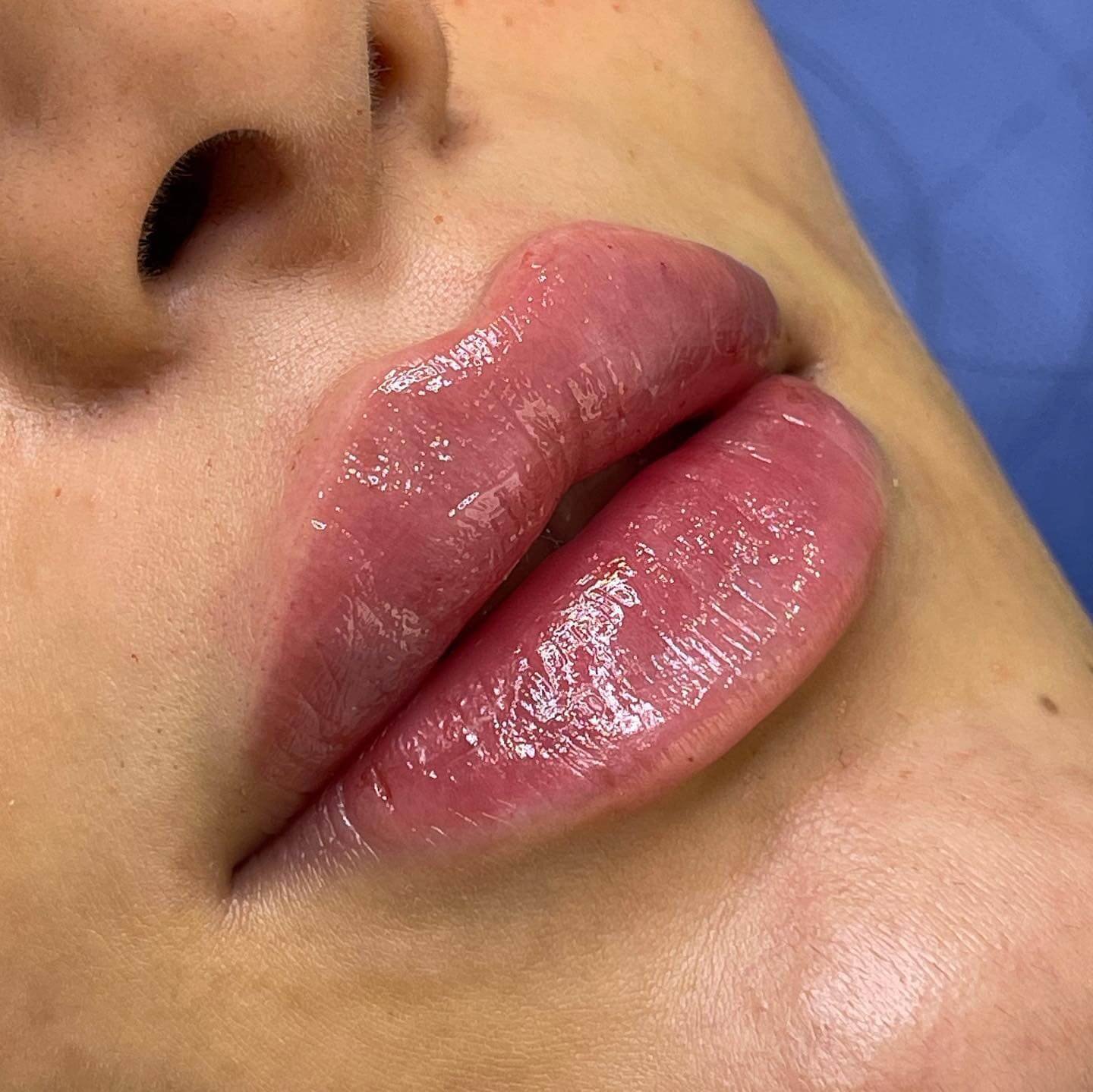 Lip blush result at Helena Aesthetics Middlesbrough