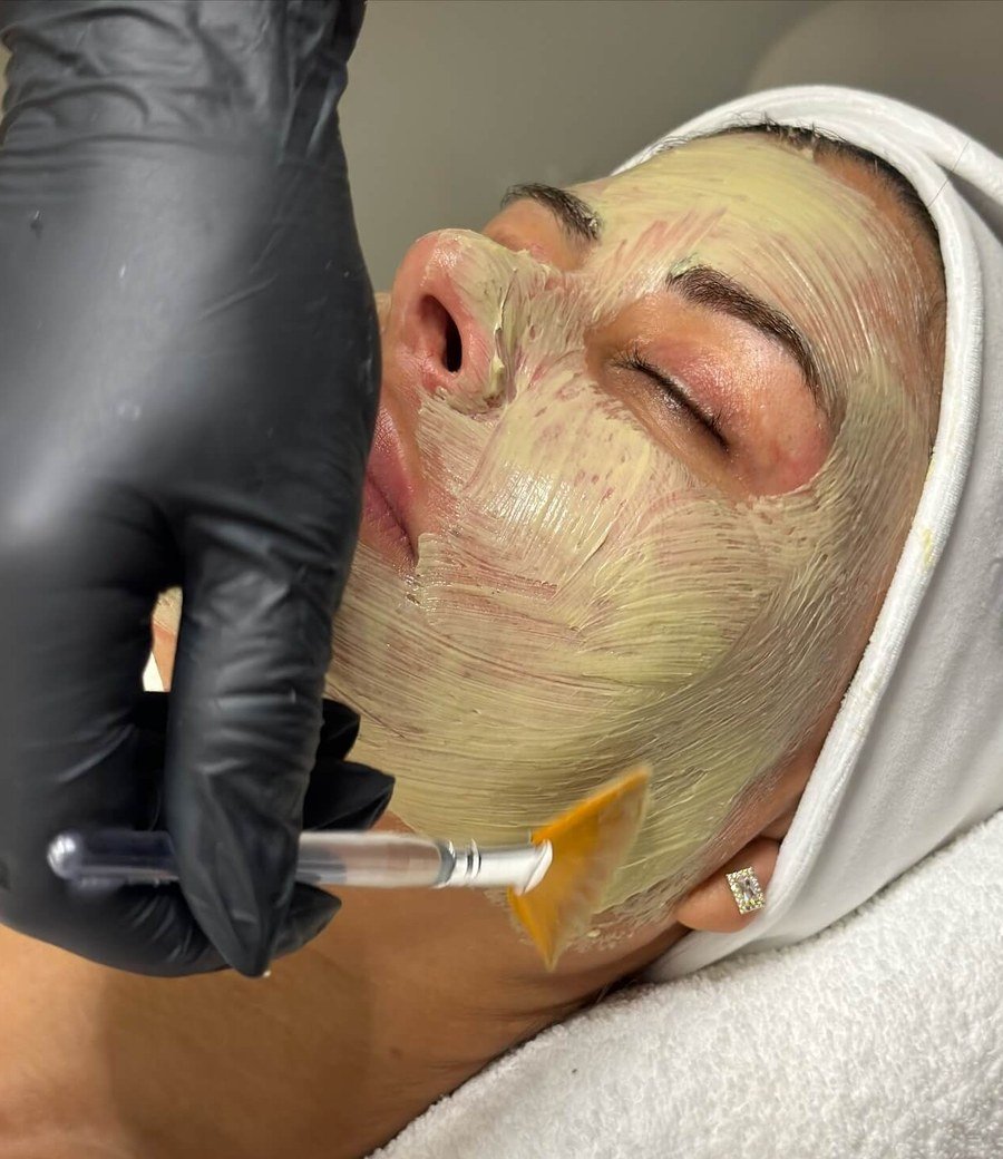 A client receiving a skin treatment at Helena Aesthetics in Middlesbrough